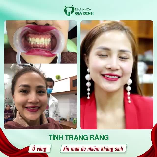 KHÁCH HÀNG CƯỜI NHIỀU HƠN KHI ĐẾN VỚI NHA KHOA GIA ĐÌNH