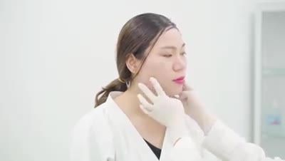 Khách hàng kiểm tra cơ cứng hàm và tư vấn Botox thon gọn hàm. Cùng chờ đón sự thay đổi của khách hàng sau 1 tháng nữa nhé