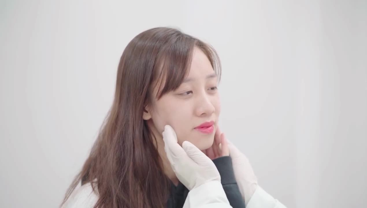 Khách hàng kiểm tra Vline Perfect sau 2 tháng và làm filler cằm để có cằm tròn đầy cân đối mang lại nét Vline hoàn hảo