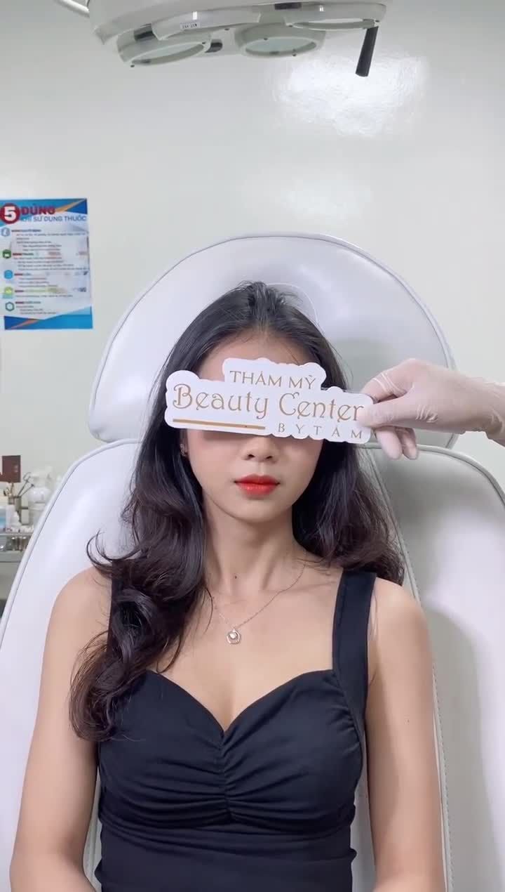 Khách hàng làm Botox thon gọn hàm sau 1 tháng quá hiệu quả quay lại làm dịch vụ Filler Cằm.