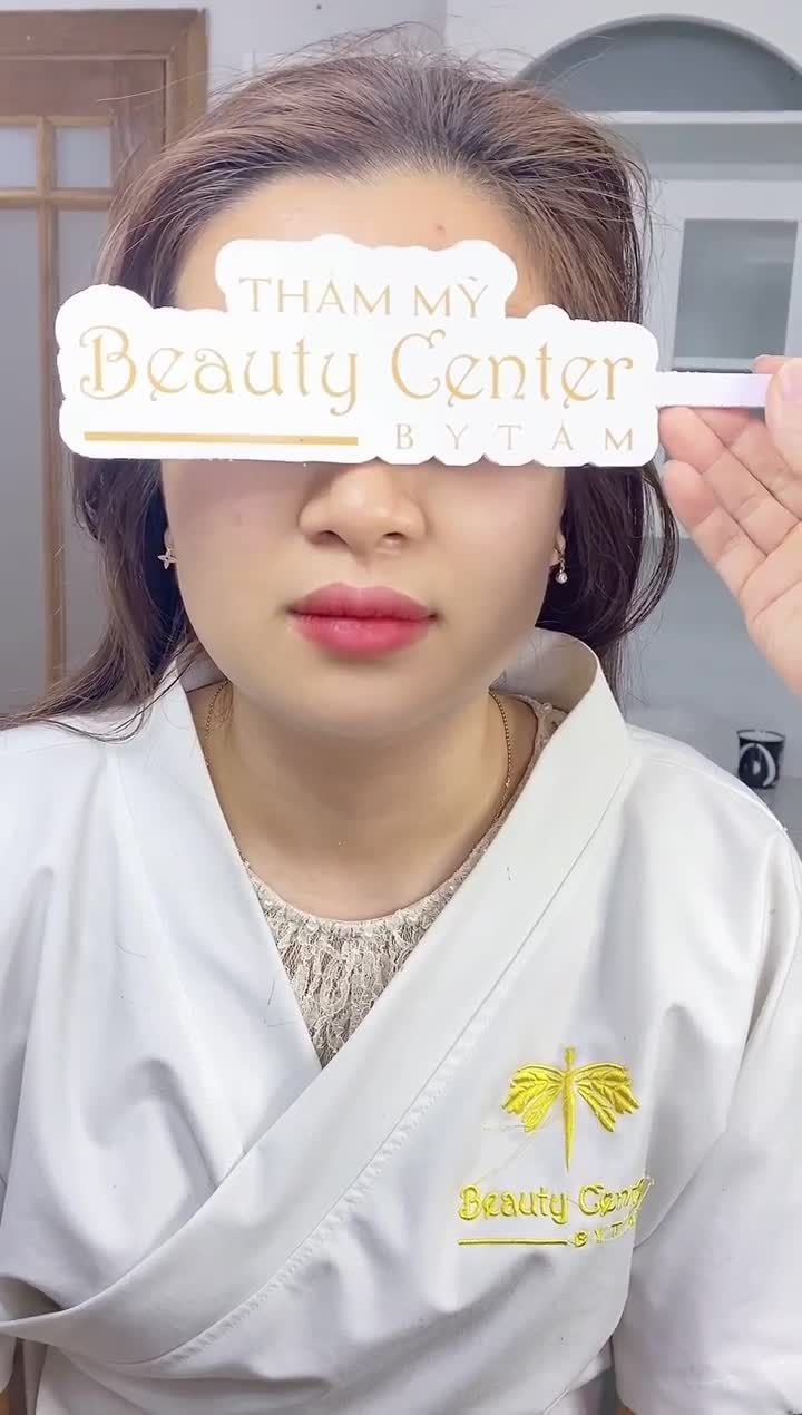 Khách hàng làm Vline Perfect- Hạ gò má- Tan mỡ nọng cằm hoàn toàn không đau, không sưng tấy, không lộ dấu vết thẩm mỹ.