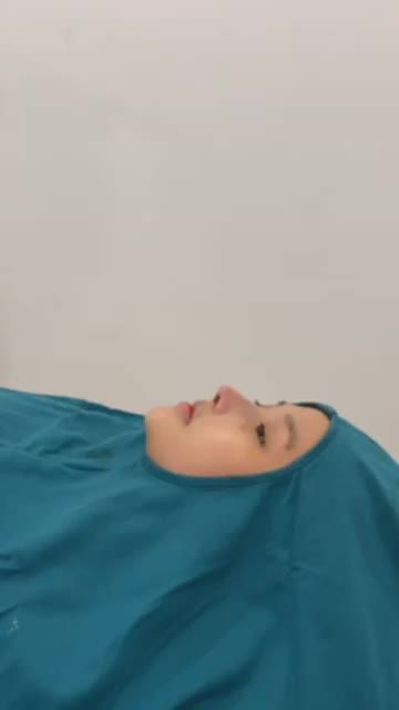khách nâng mũi cấu trúc sụn tai + bọc fassia