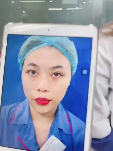 Khởi đầu ngày mới với CA COMBO Nâng mũi + Cắt cánh