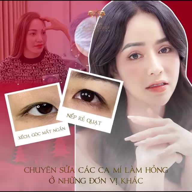 LÍ DO NÊN ĐẾN THẨM MỸ BEAUTY CENTER BY TẤM TÂN TRANG LẠI VẺ ĐẸP ĐÔI MẮT LÀ GÌ?