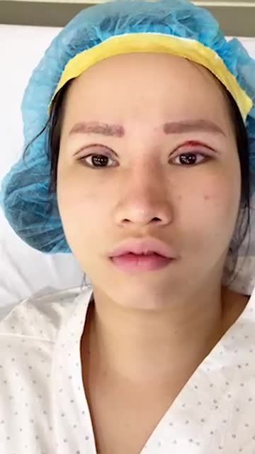 MÍ ĐẸP NGAY TẠI PHÒNG PHẪU THUẬT