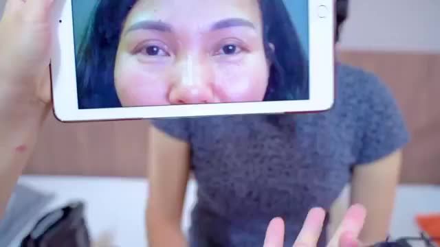 Mí lỗi hỏng sau chỉnh hình kỹ thuật DeepTech 7 ngày trông như thế nào? Mời cả nhà cùng theo dõi