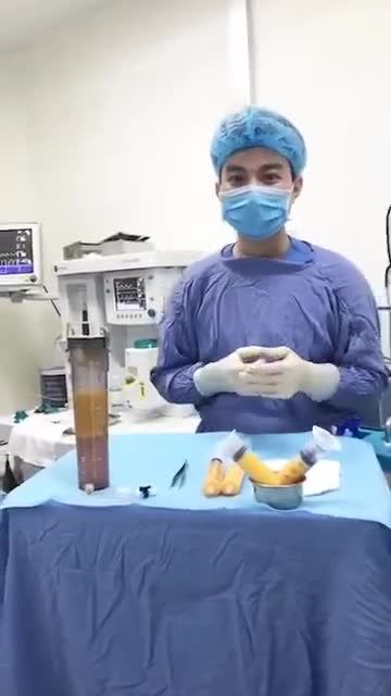 Mỡ sau khi hút từ vùng bụng, vùng đùi sẽ được xử lý như thế nào?