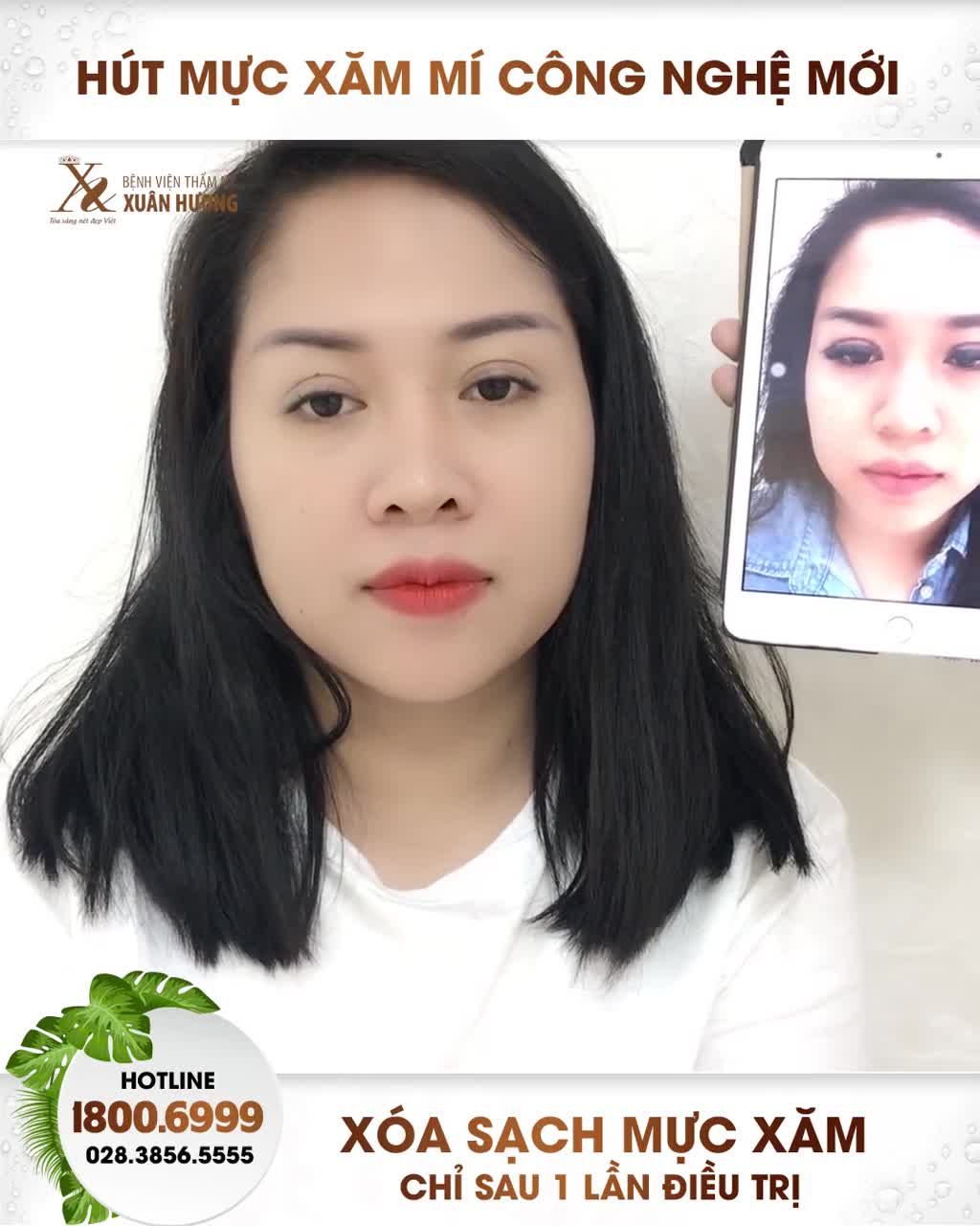 "MỰC XĂM MÍ MỜ NHANH VƯỢT XA CẢ MONG ĐỢI CỦA MÌNH"