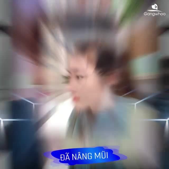 MŨI ĐẸP CHUẨN HÀN SAU NÂNG MŨI CẤU TRÚC DÁNG S-LINE 6D