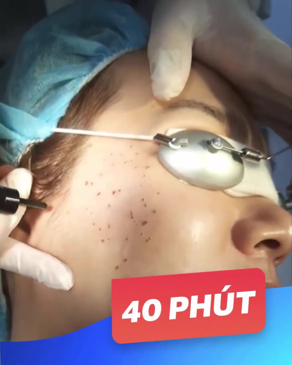 Mụn thịt quanh mắt, má, cổ, lưng,...Không can thiệp Lây lan mất kiểm soát