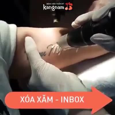 Muốn XÓA XĂM Nhanh nhưng không để lại SẸO