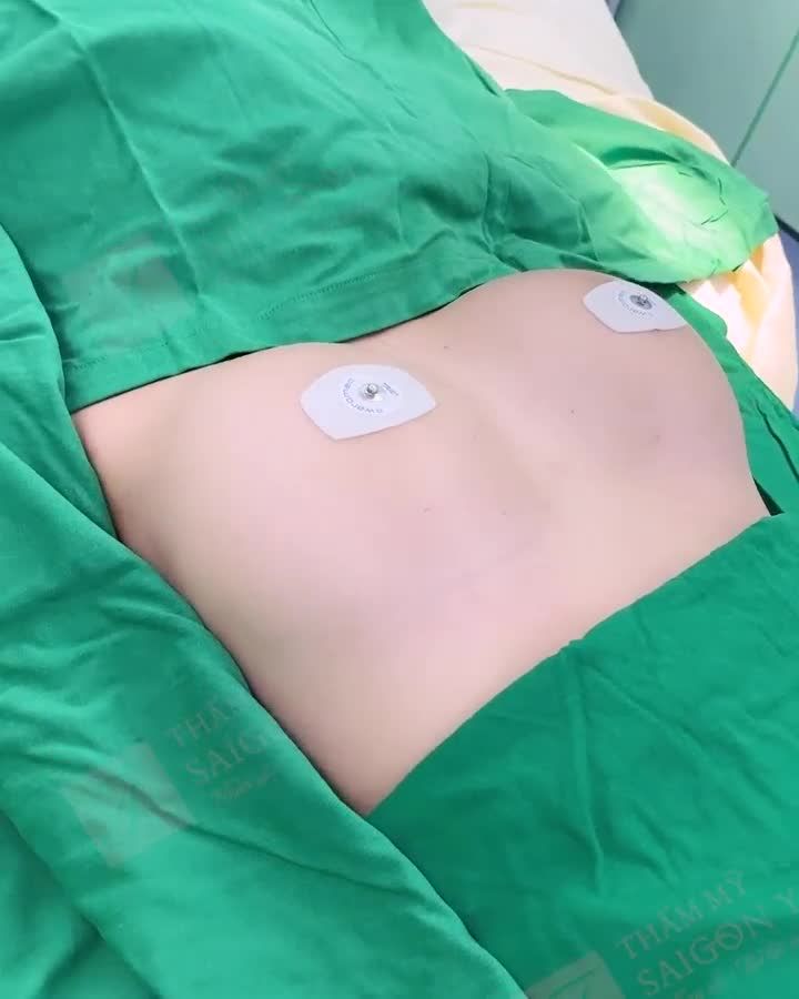 NÂNG CẤP V1 NỘI SOI TẠI SAIGON YOUNG