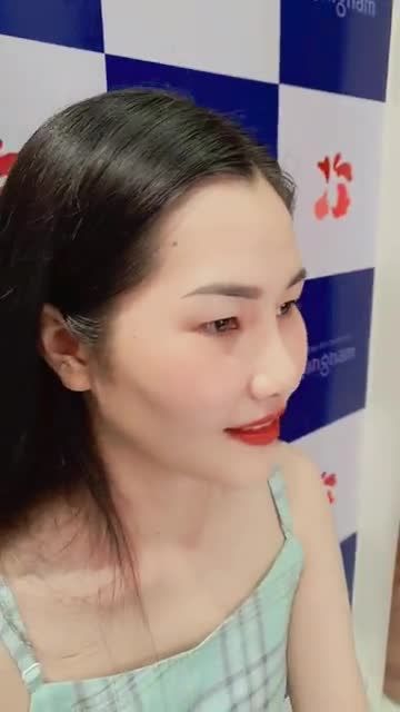 Nâng mũi Đẹp An Toàn - Giá Tiết Kiệm