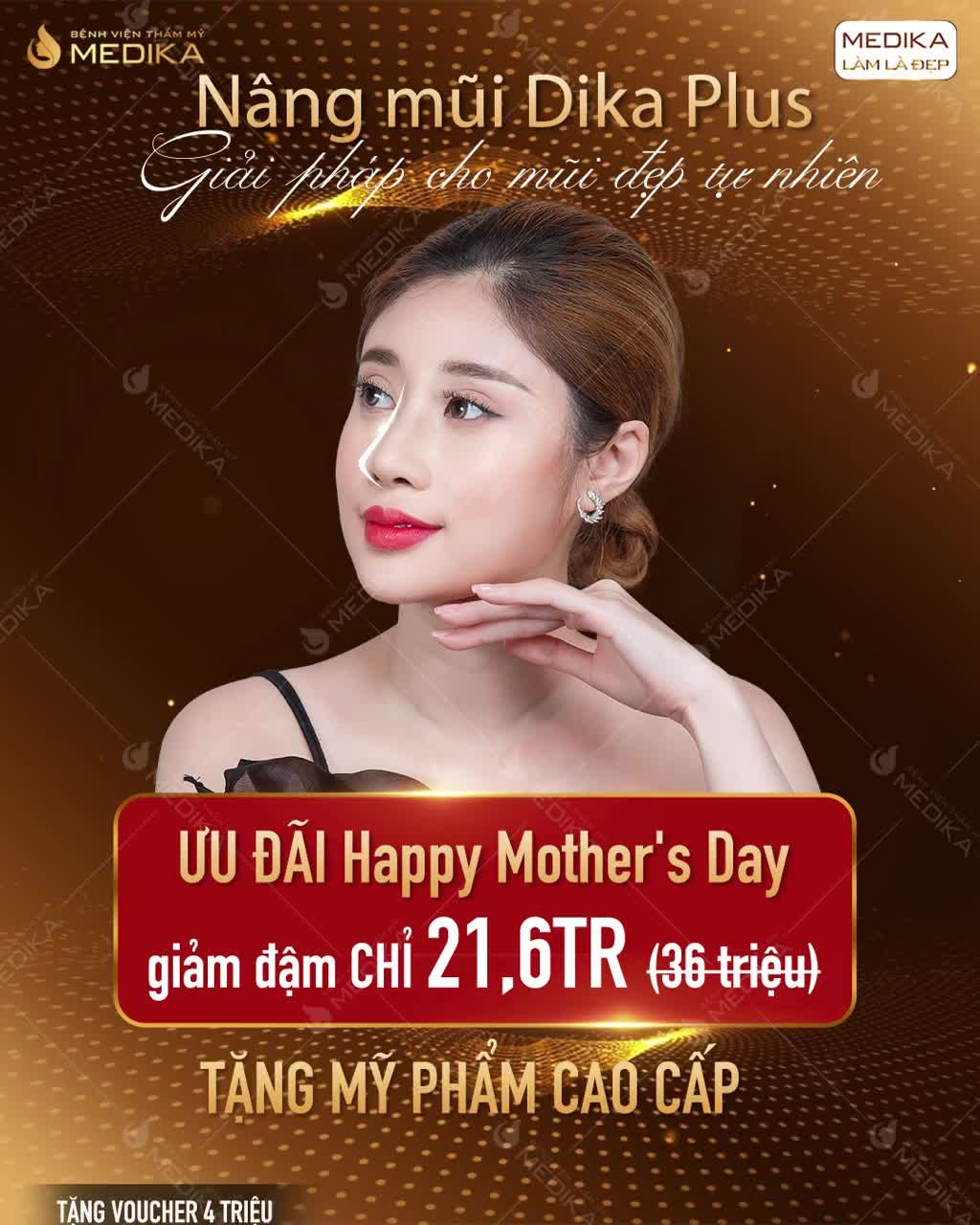 NÂNG MŨI DIKA PLUS - LỰA CHỌN HOÀN HẢO CHO MŨI ĐẸP TỰ NHIÊN