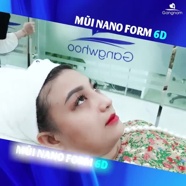 NÂNG MŨI NANOFORM 6D – LÀM 1 LẦN ĐẸP 1 ĐỜI