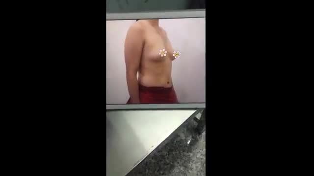 Nâng ngực Không Khâu Da là phương pháp làm đẹp cho vòng 1 vừa nhanh vừa hiệu quả rõ rệt, các chị em mình tham khảo để làm nhé!