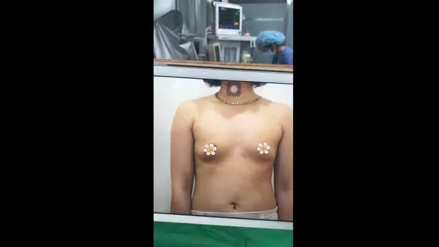 Nâng ngực nội soi tạo bầu ngực căng đầy, quyến rũ giải pháp cho các bạn nữ, hội mẹ bỉm sữa với ngực chảy xệ mức độ nhẹ hay ngực lép, phẳng là đây chứ đâu