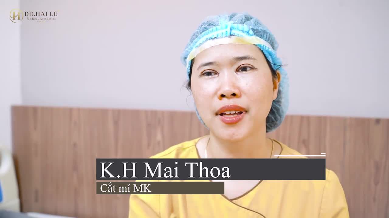 Nếu bạn đang có ý định thực hiện Cắt mí bạn không thể bỏ qua video: