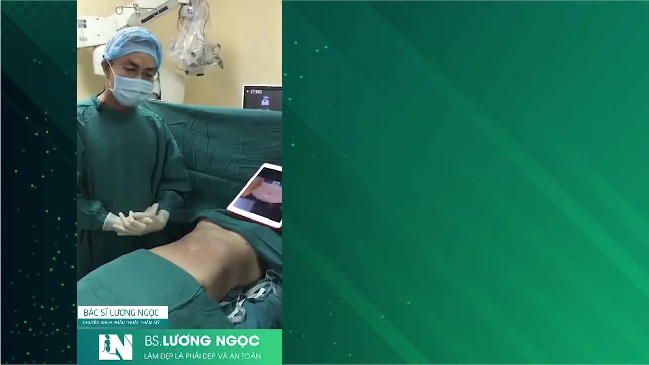 Nhiều chị em thắc mắc, tại sao lại có tấm màn chắn ngang, che đi phần mặt của Khách hàng mỗi khi phát video chia sẻ kết quả hút mỡ tạo dáng?