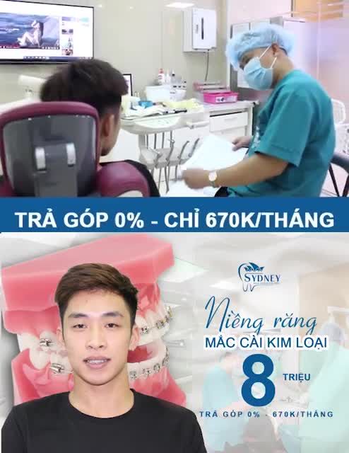 NHỮNG ƯU ĐIỂM CỦA NIỀNG RĂNG MẮC CÀI KIM LOẠI THƯỜNG
