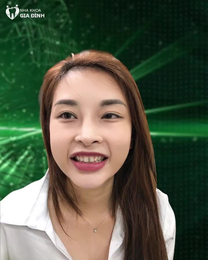 NỤ CƯỜI HOÀN HẢO – “GIẤY THÔNG HÀNH” CHO TƯƠNG LAI CỦA BẠN