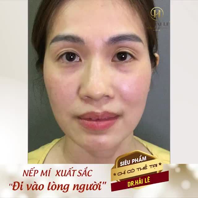 Nụ cười trên đôi mắt tươi trẻ
