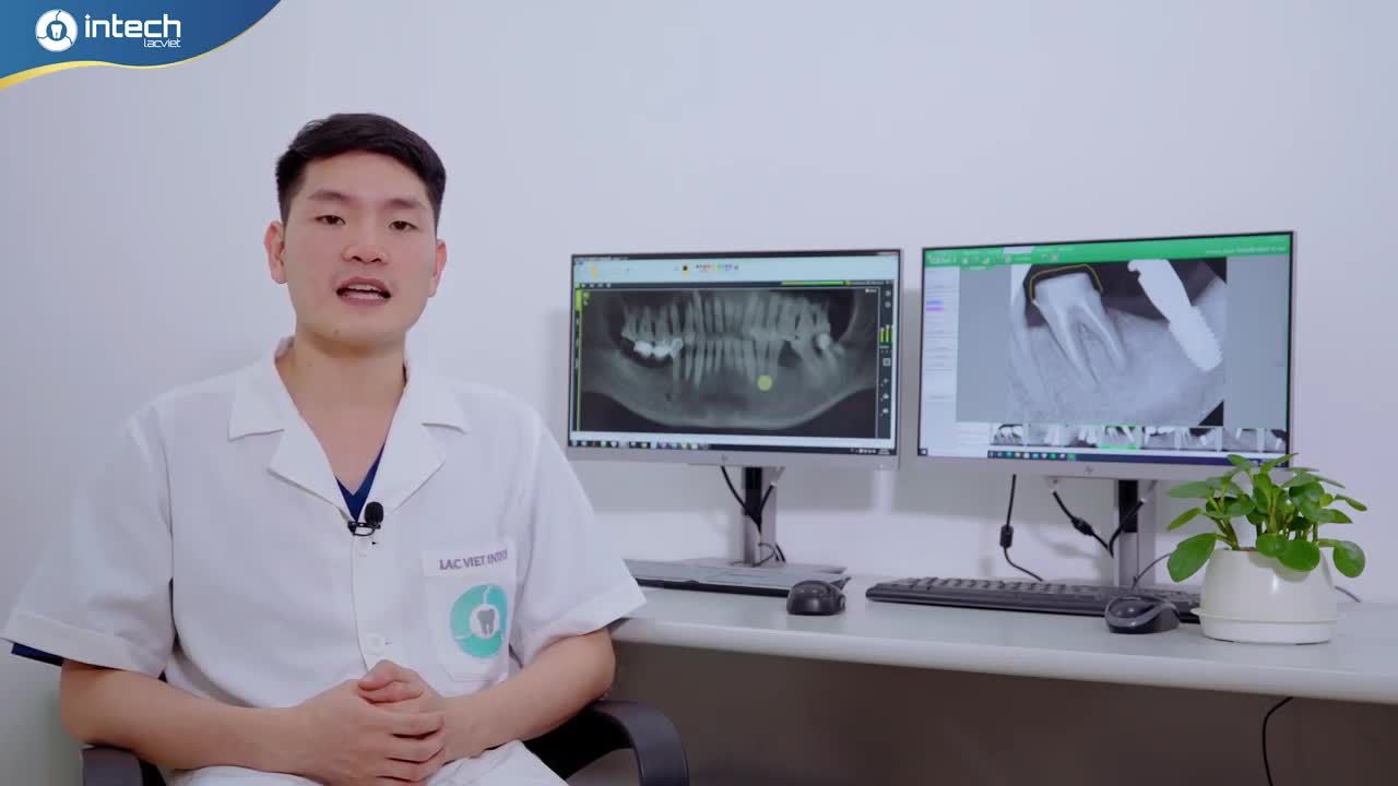 PHÂN TÍCH LÂM SÀNG CÙNG BÁC SĨ BÙI VĂN HƯNG - BÁC SĨ CẤY GHÉP IMPLANT ĐANG CÔNG TÁC TẠI NHA KHOA LẠC VIỆT INTECH CẦU GIẤY