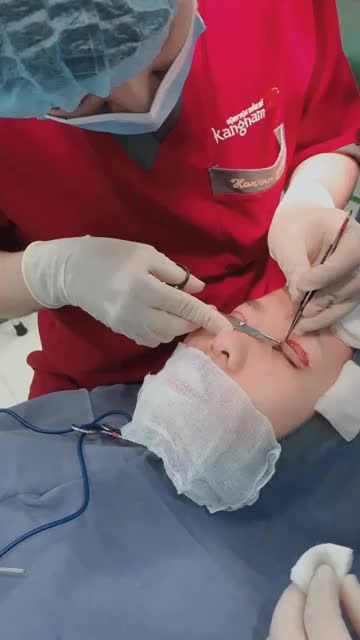 Quá trình KHÂU KÍN SAU CẮT MÍ PLASMA tại Kangnam