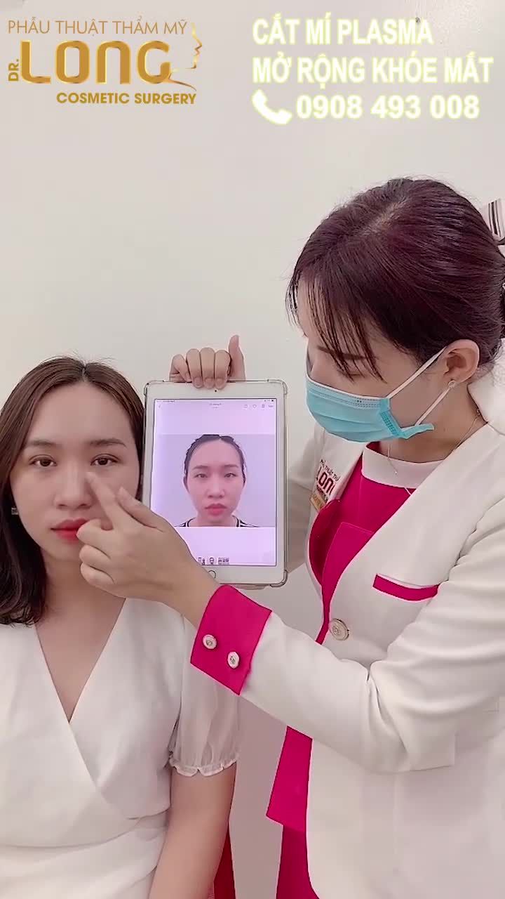QUÁ TRÌNH TRƯỚC VÀ SAU KHI CẮT MÍ CỦA KHÁCH HÀNG