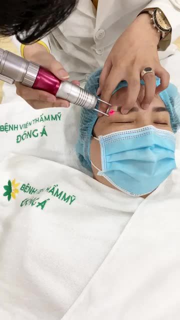 Quá trình xoá xăm lông mày tại bệnh viện thẫm mỹ Đông Á