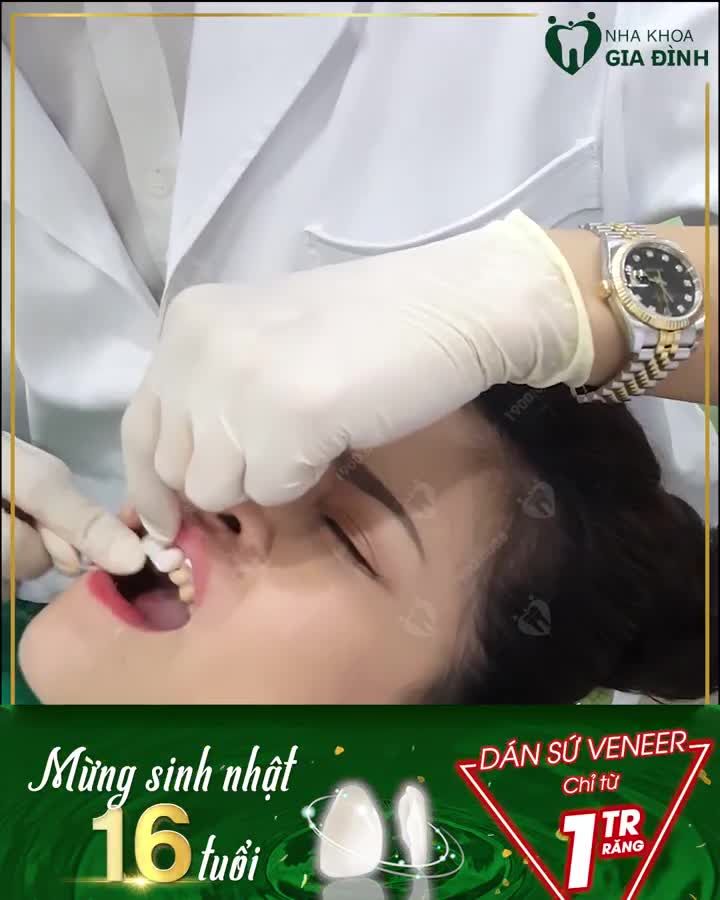 RĂNG ĐẸP THẾ NÀY MÊ MẨN TỪ CÁI NHÌN ĐẦU TIÊN