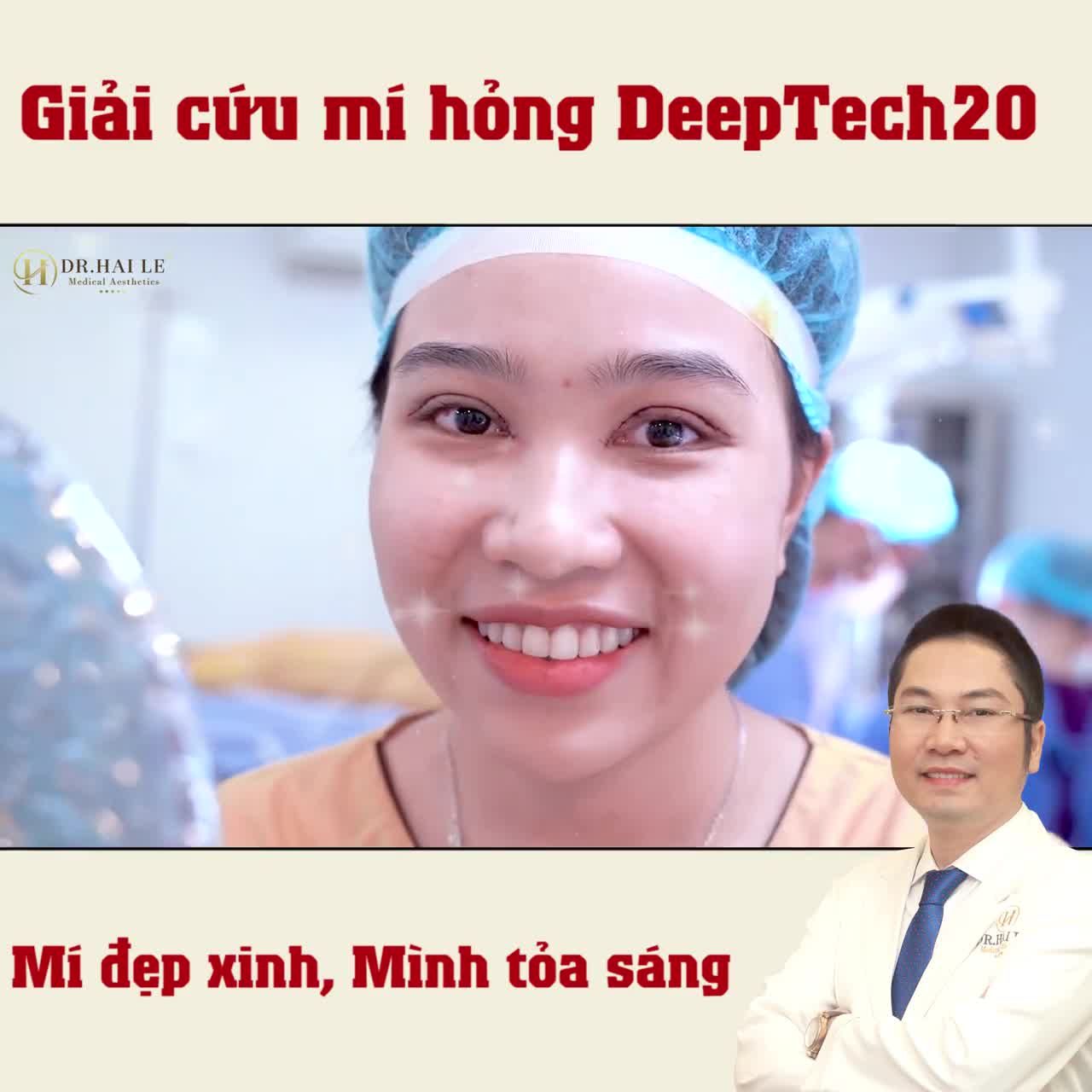 REVIEW - SỬA MÍ HỎNG DR.HẢI LÊ CƠ SỞ HCM