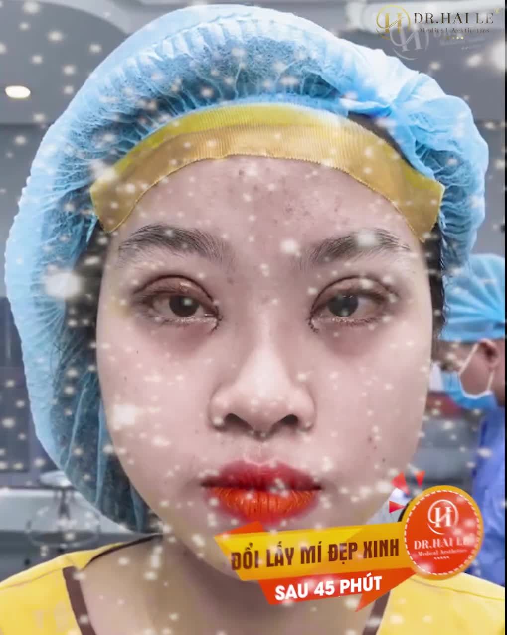 REVIEW - SỬA MÍ LỖI HỎNG DR.HẢI LÊ CƠ SỞ HCM
