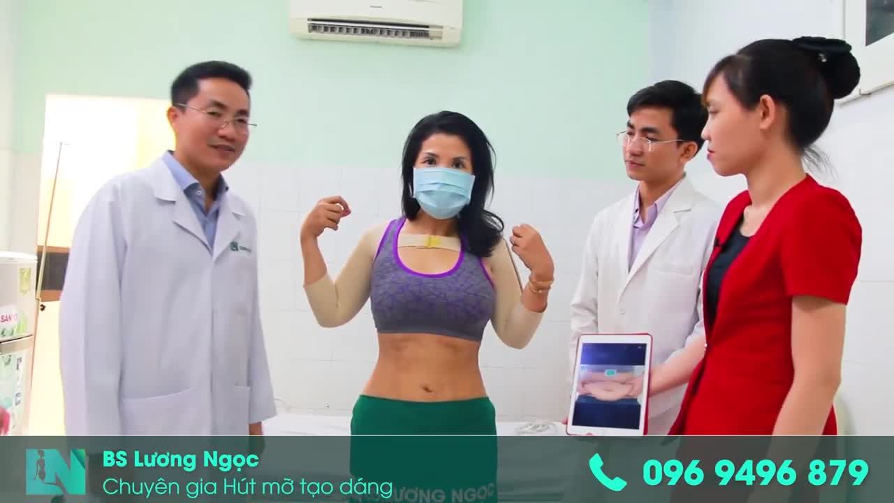 SAU 2 TUẦN THỰC HIỆN HÚT MỠ BỤNG