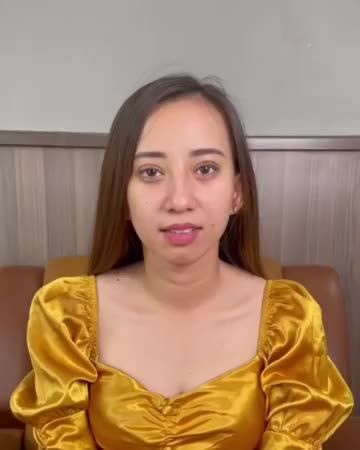 Sau 7 ngày Cắt mí khách hàng xinh quá bác sĩ nhận không ra