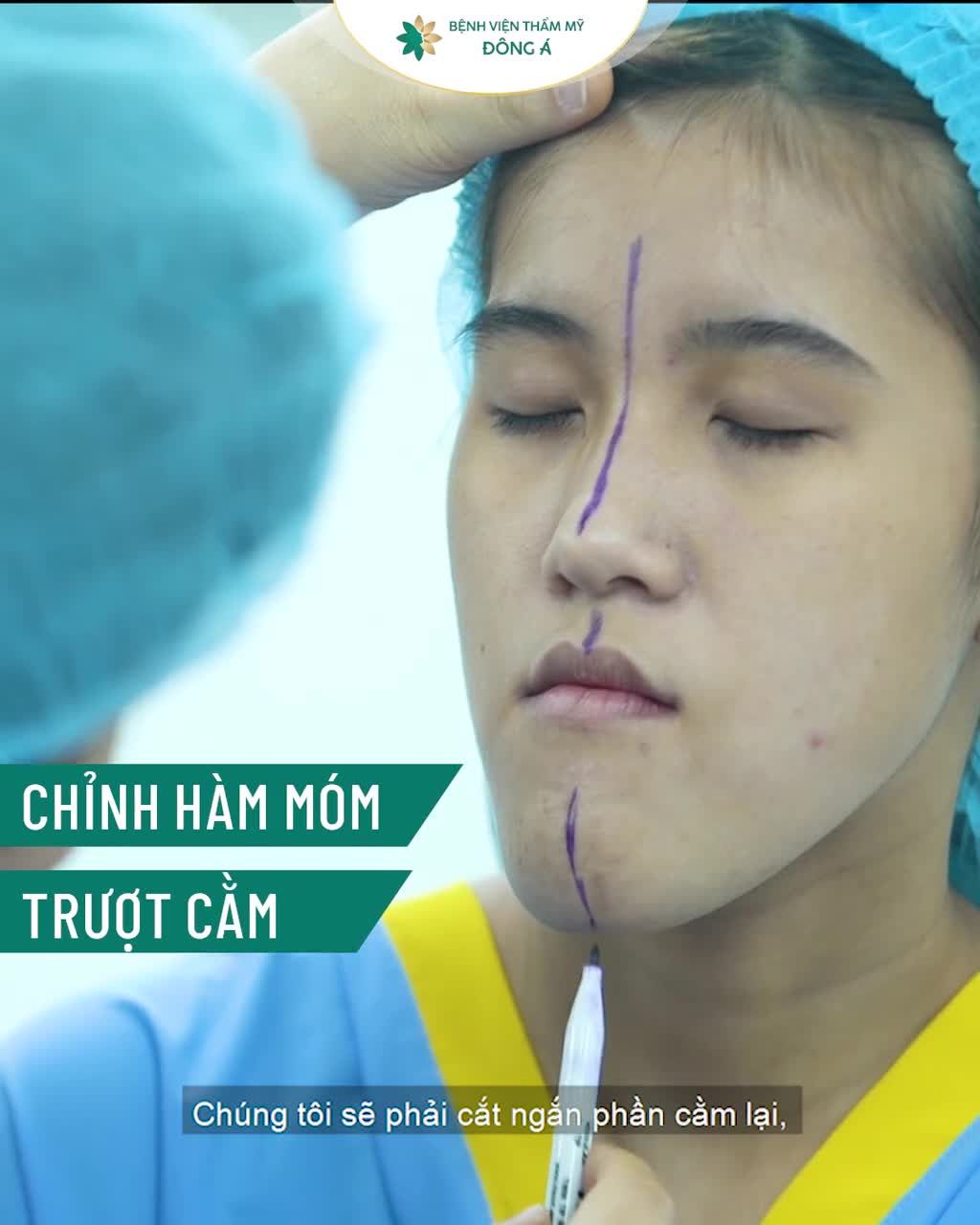 Tái sinh ca "mặt lưỡi cày" khó kinh điển: