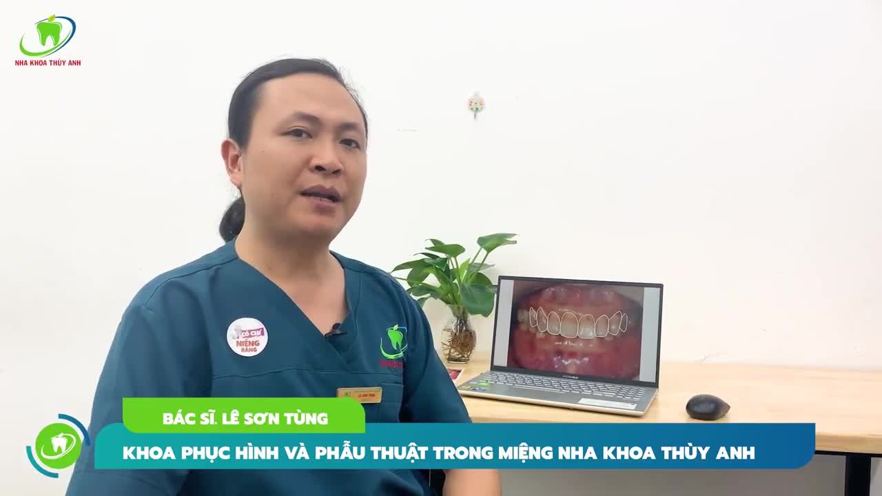 TẠM BIỆT HÀM RĂNG XỈN MÀU CHỈ SAU 72H VỚI DÁN SỨ VENEER