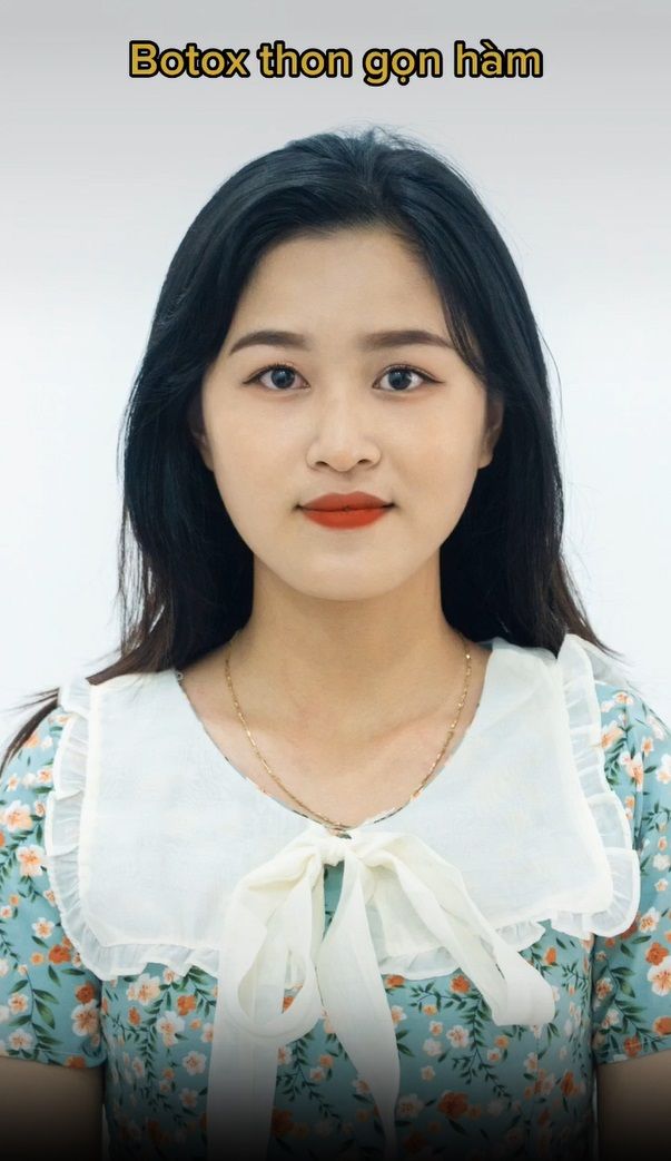 Tạm biệt mặt to- không còn âu lo