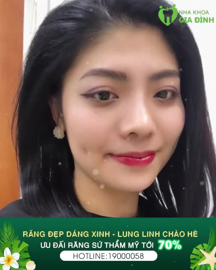 THĂM KHÁM NHIỀU NƠI NHƯNG QUYẾT ĐỊNH LÀM VẪN CHỈ LÀ NHA KHOA GIA ĐÌNH