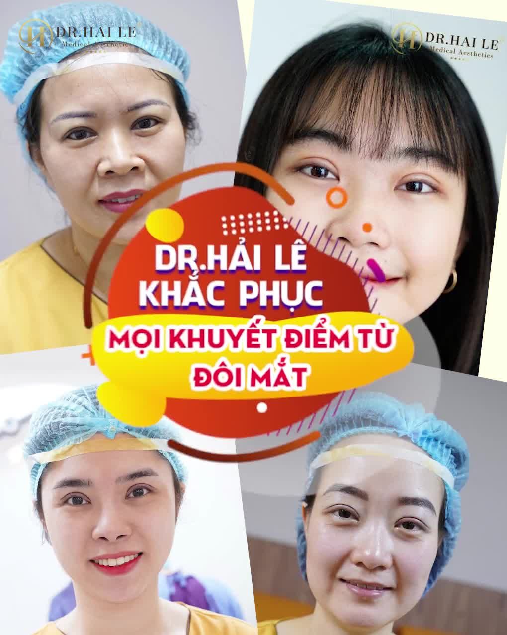THẨM MỸ MẮT - NHỮNG ĐIỀU CẦN BIẾT