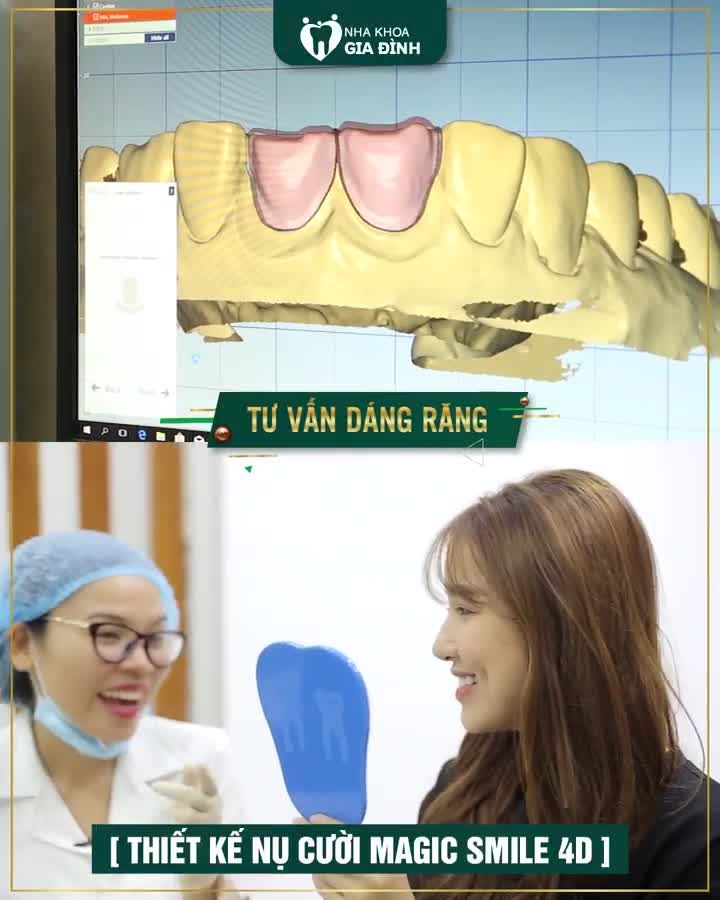 THẨM MỸ RĂNG TRỰC TIẾP BỞI CHUYÊN GIA TRÊN 15 NĂM KINH NGHIỆM