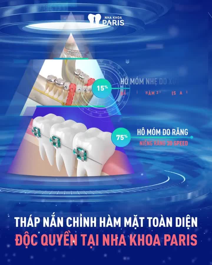 Tháp nắn chỉnh Răng Hàm Mặt