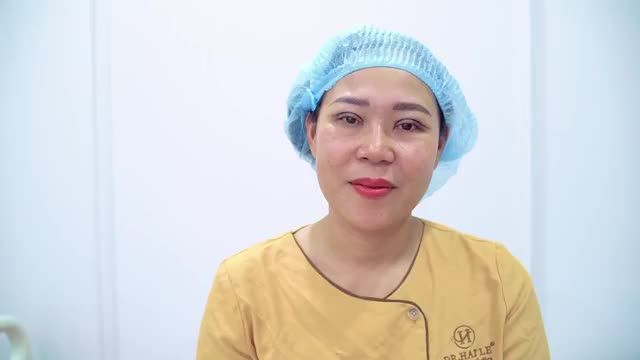 Theo dõi kết quả Cắt mí giúp khách hàng sở hữu mắt 2 mí vô cùng rạng rỡ