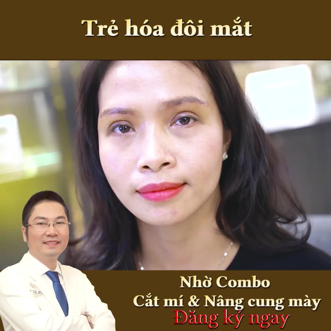 Tiếp tục cho các bạn chiêm ngưỡng sức mạnh Trẻ hóa đôi mắt nhờ PTTM