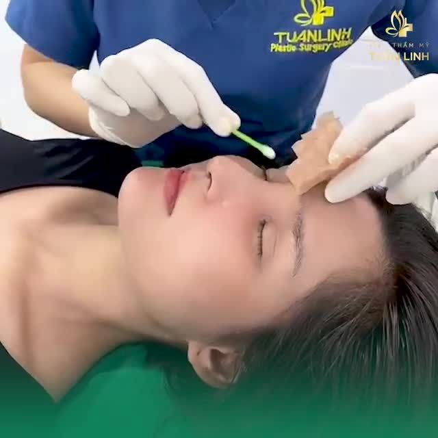 TIN NỔI KHÔNG: MŨI VÀO PHOM CHỈ SAU 10 NGÀY