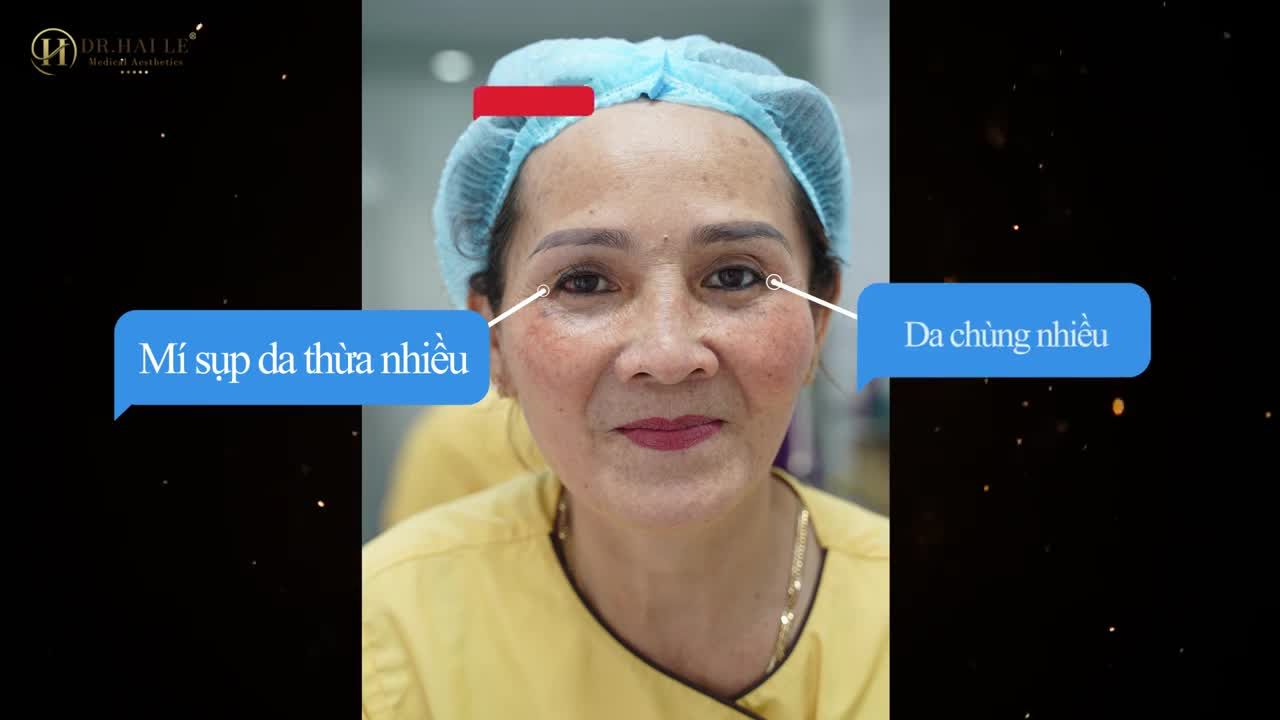"Tôi ở Cà Mau nghe bà con kháo nhau Bác sĩ trên đây làm đẹp, tui lên tui làm và đúng nó đẹp thật..."
