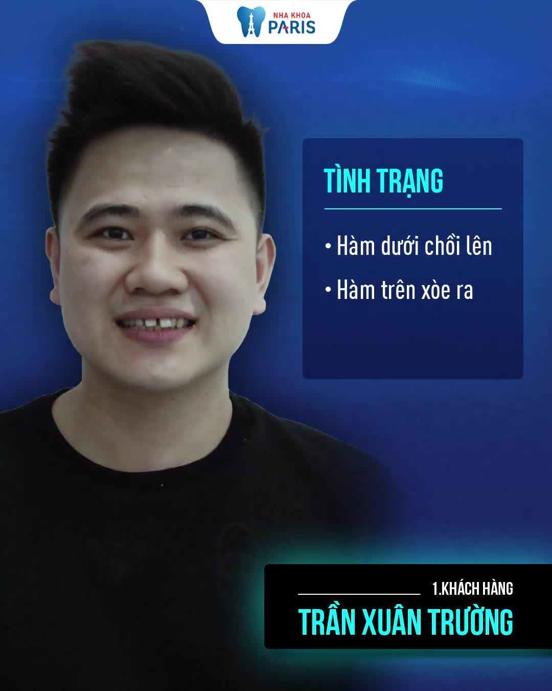 Top 5 Ca Niềng Răng- Tự hào Y Học VN