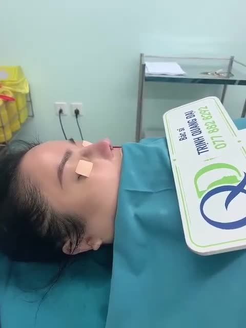 Trả kết quả case mũi tái cấu trúc tối muộn ngày hôm qua nha cả nhà ơi!
