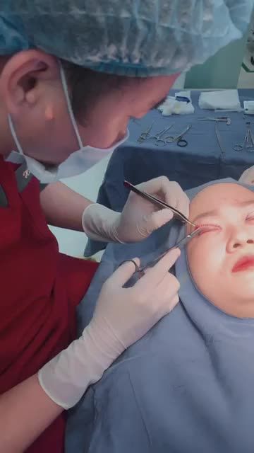 Trợ giá mùa COVID: CẮT MÍ tặng tới 4.5 TRIỆU Tia Plasma siêu mảnh Tạo nếp mí tự nhiên, rõ nét