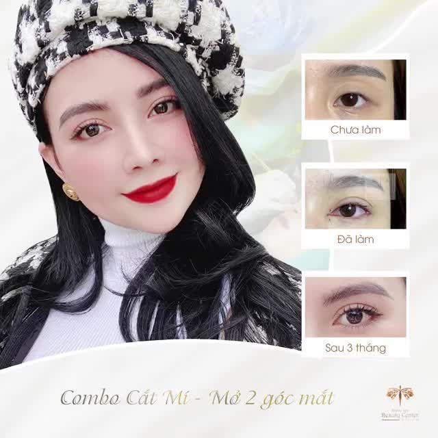 “Từ khi quyết định sẽ tân trang lại đôi mắt, Tấm là địa chỉ đầu tiên và duy nhất mà mình tin tưởng lựa chọn”